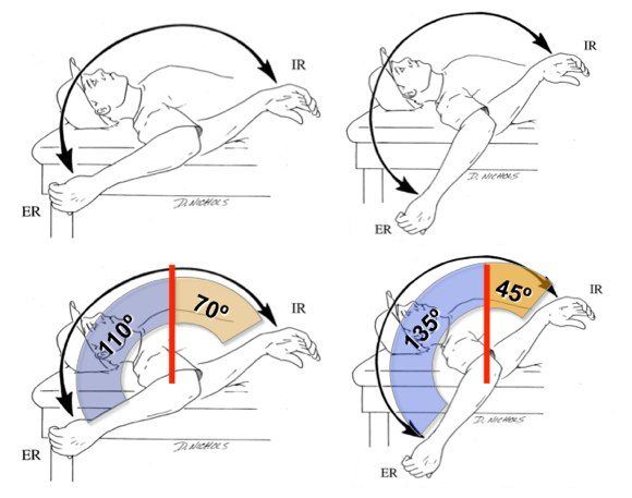 GIRD glenohumeral internal rotation deficit