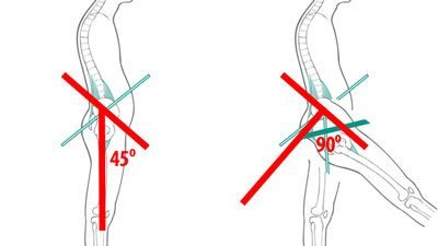 Anterior Pelvic Tilt