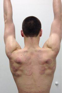 assessing overhead arm elevation