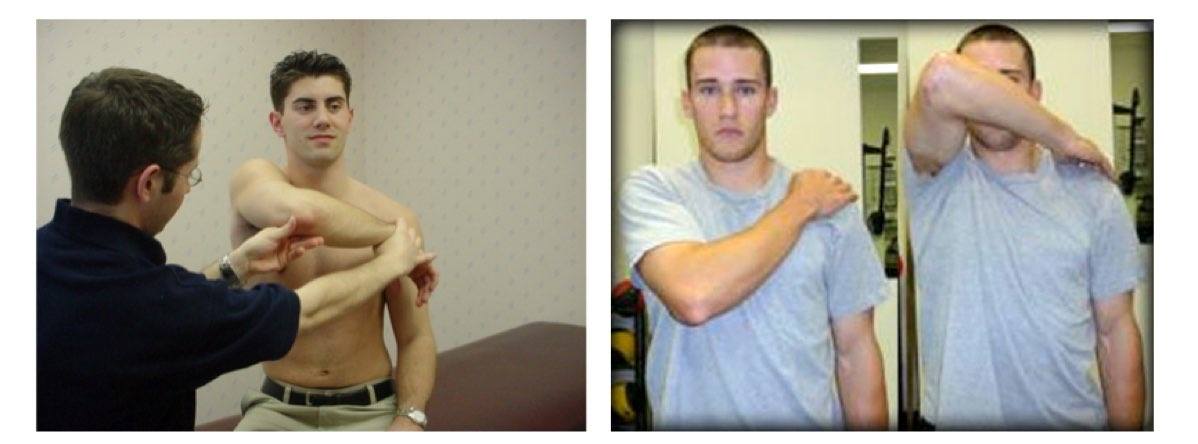 how to assess shoulder impingement