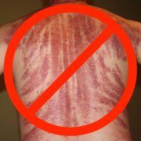 iastm myths